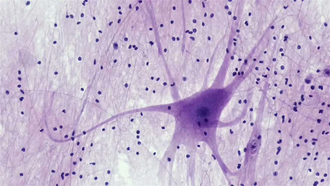 Zgomotul neuronal comun nu limitează capacitatea de procesare a creierului