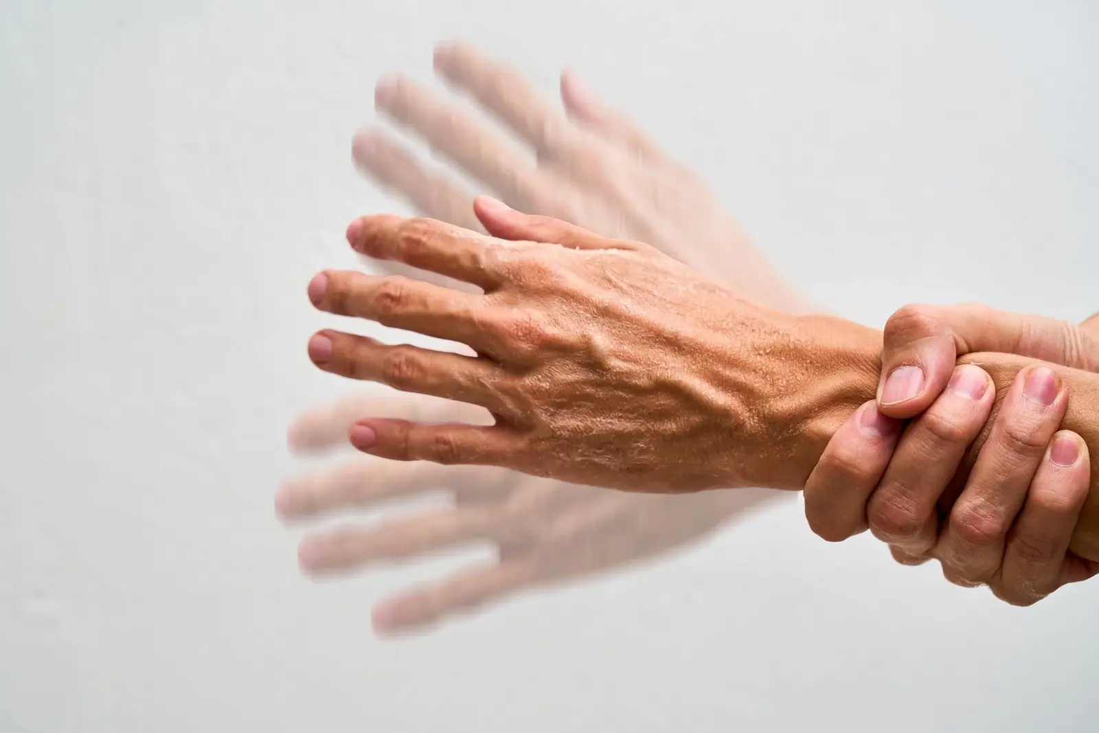 Supplimentul cu nicotinamidă ribozidă nu a îmbunătățit simptomele la Parkinson în stațiile inițiale